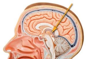 the anatomy of brain rot